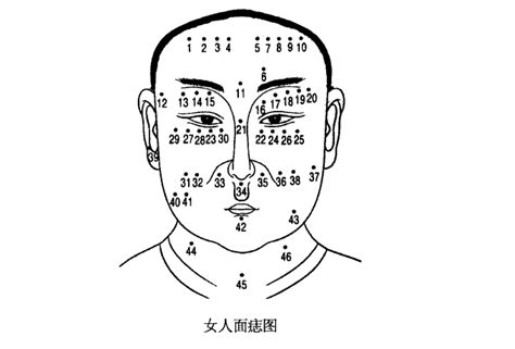 宜夫痣 什么意思